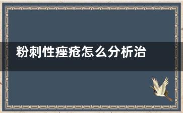 粉刺性痤疮怎么分析治疗 黑头粉刺怎么治疗